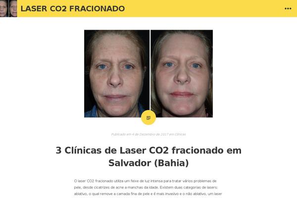 laserco2fracionado.com site used WpF Flaty