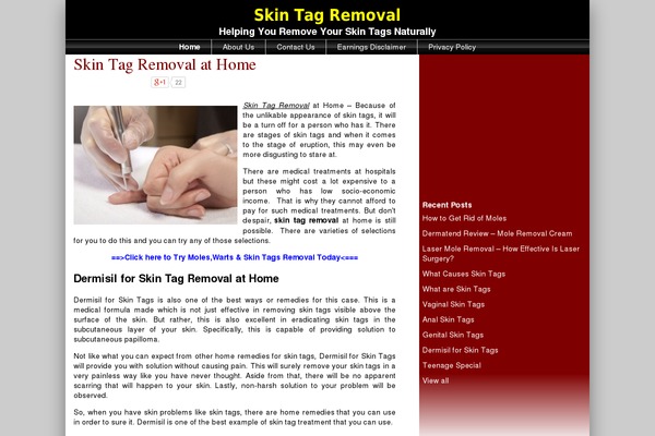 skintagremoval.org.uk site used Ce4