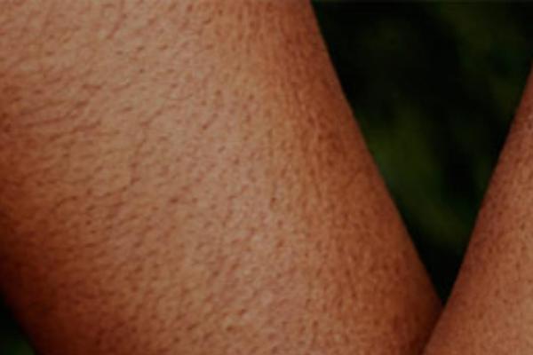 Site using Cornerstone plugin