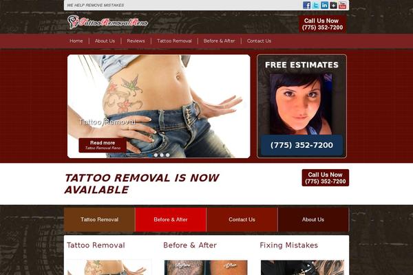 tattooremovalreno.com site used Christianus