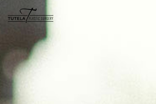 Site using Baslider plugin